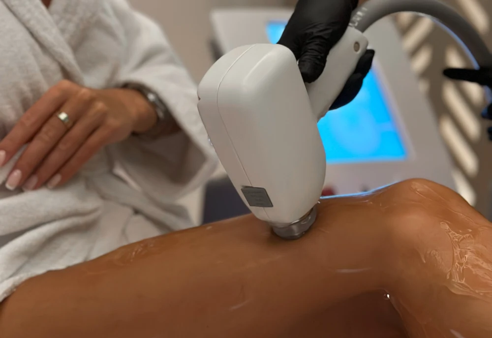 Laser Haarentfernung